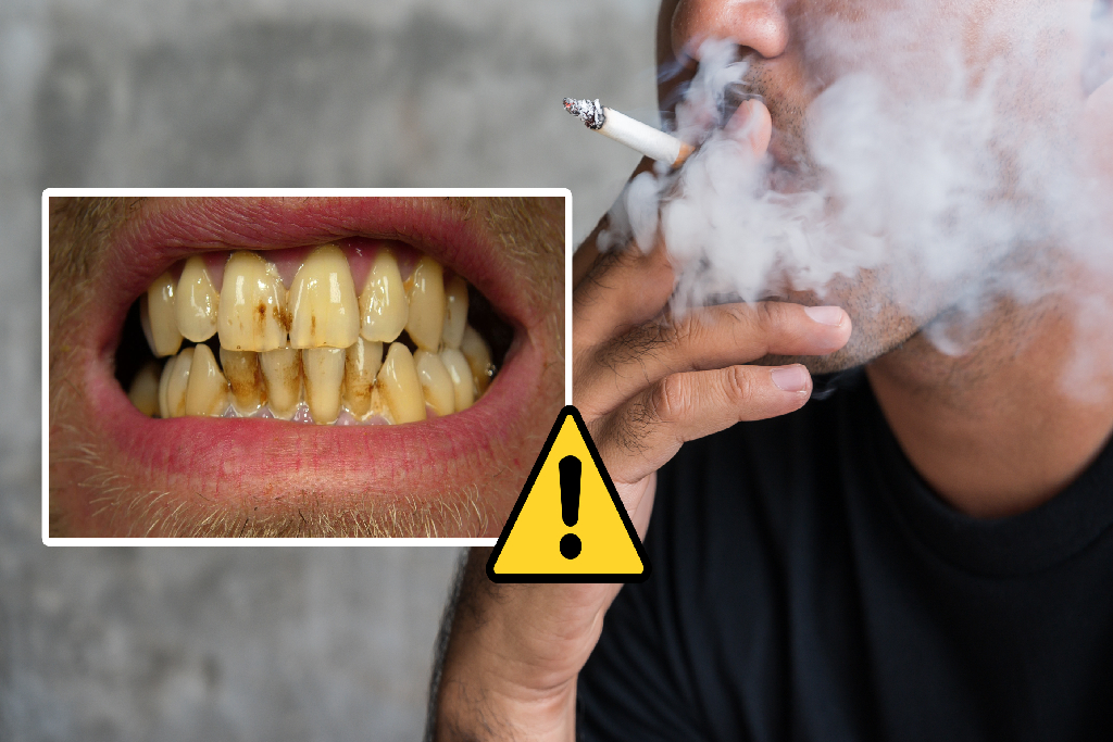 Is Smoking and Sucking Bad for Your Teeth?