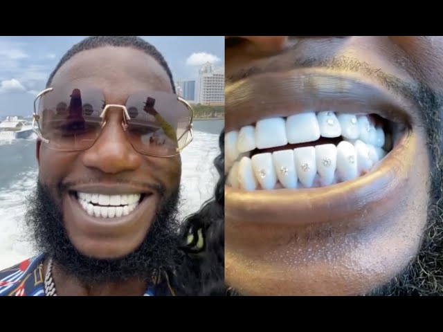 Gucci Mane Teeth: How Much Did They Cost? (The Price of a Perfect Smile)
