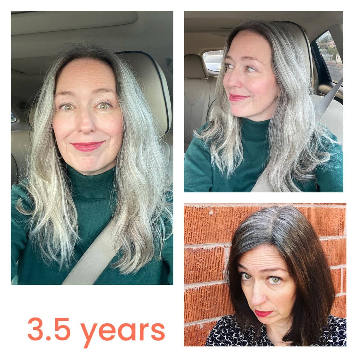 Tired of 1s Grey Hair? Heres How to Get Your Color Back