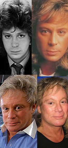 The Mystery of Eric Carmen Plastic Surgery: What We Know So Far