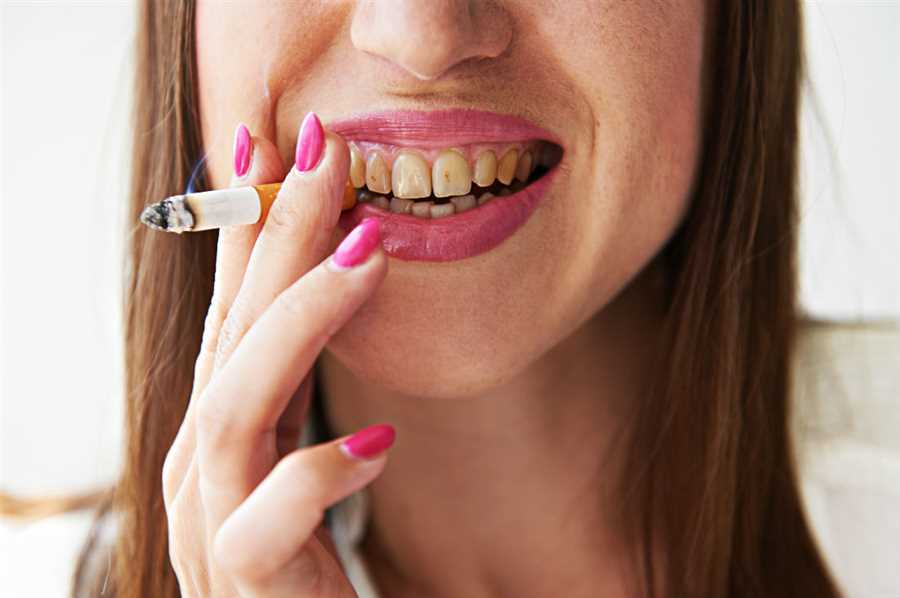 Is Smoking and Sucking Bad for Your Teeth?