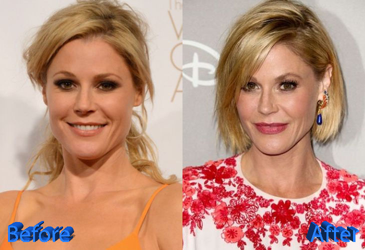 Unveiling the Truth: Julie Bowen and Plastic Surgery Speculation