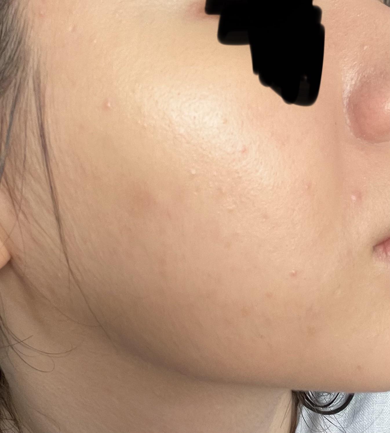 MISSHA M BB Cream Review: See Before You Buy and Final Thoughts