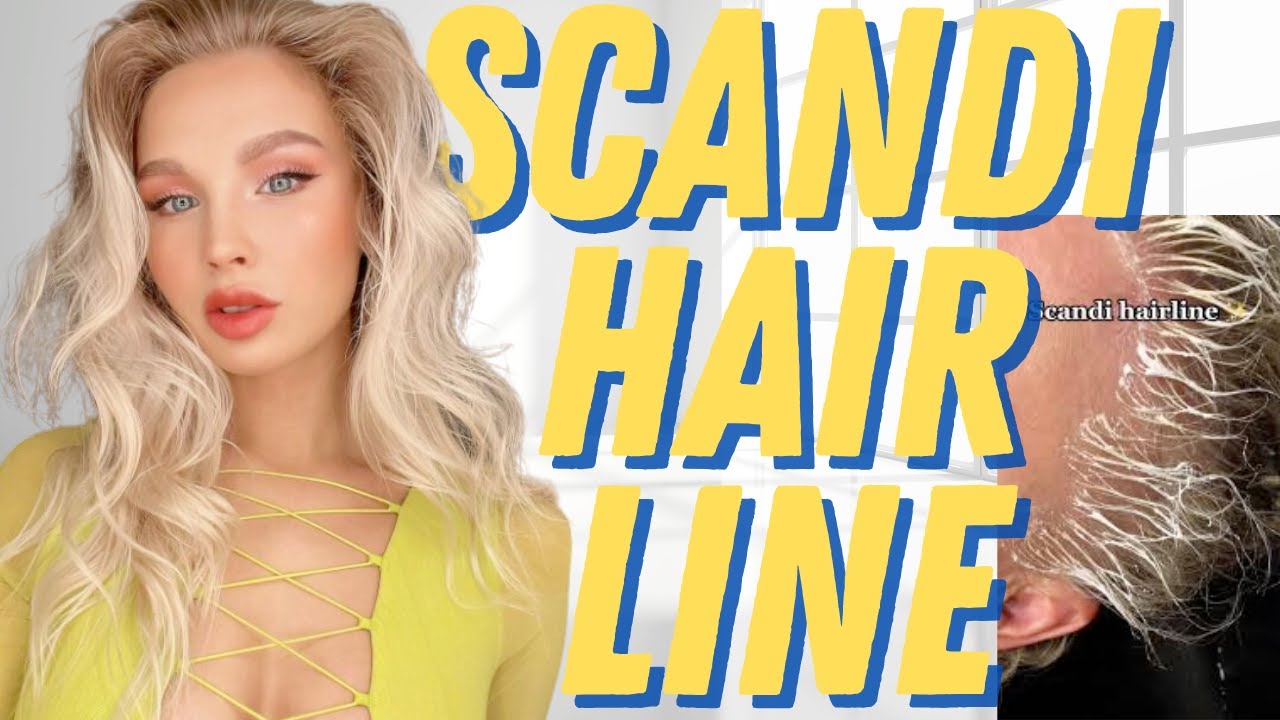 Get a Scandinavian Hairline: The Simple Guide for a Soft Look!