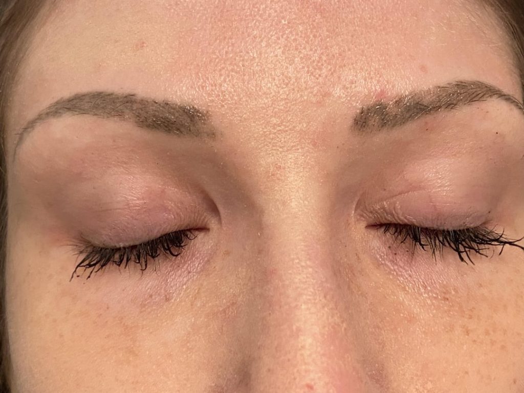I Ruined My Microblading:How to Fix a Microblading Mistake.