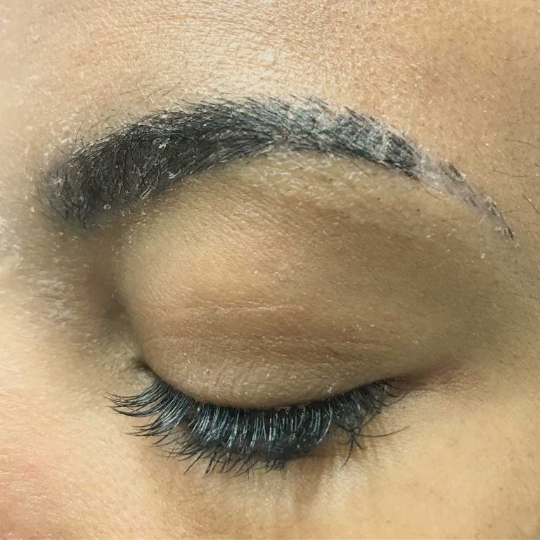 I Ruined My Microblading:How to Fix a Microblading Mistake.