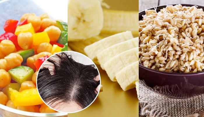 Dry Scalp and Diet: Foods that Can Fight Flakes Fast.