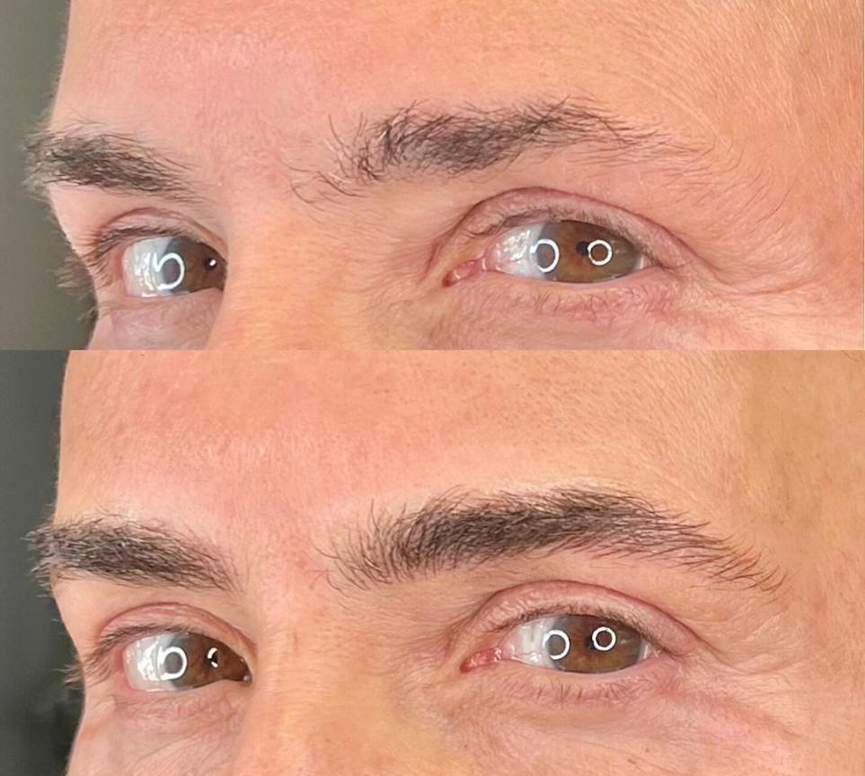 Mens Eyebrows Before and After: Tips for a Great Look