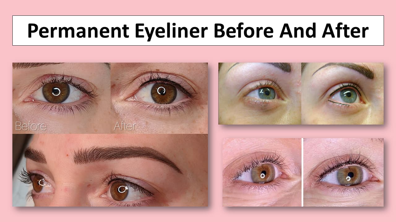 Looking for eyeliner tattoo pictures? See these incredible before and after transformations from real people.