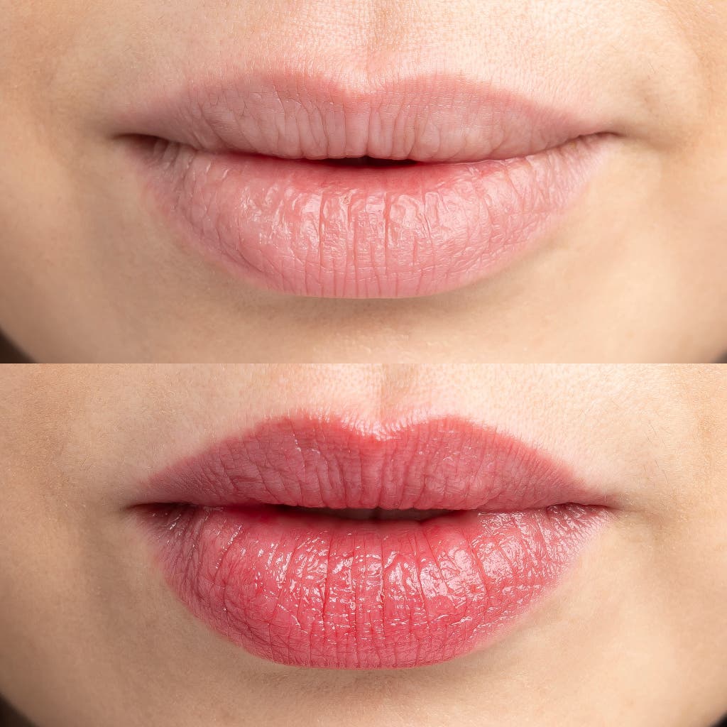 Want a healthier looking natural lip color? Try these easy home remedies starting tonight.