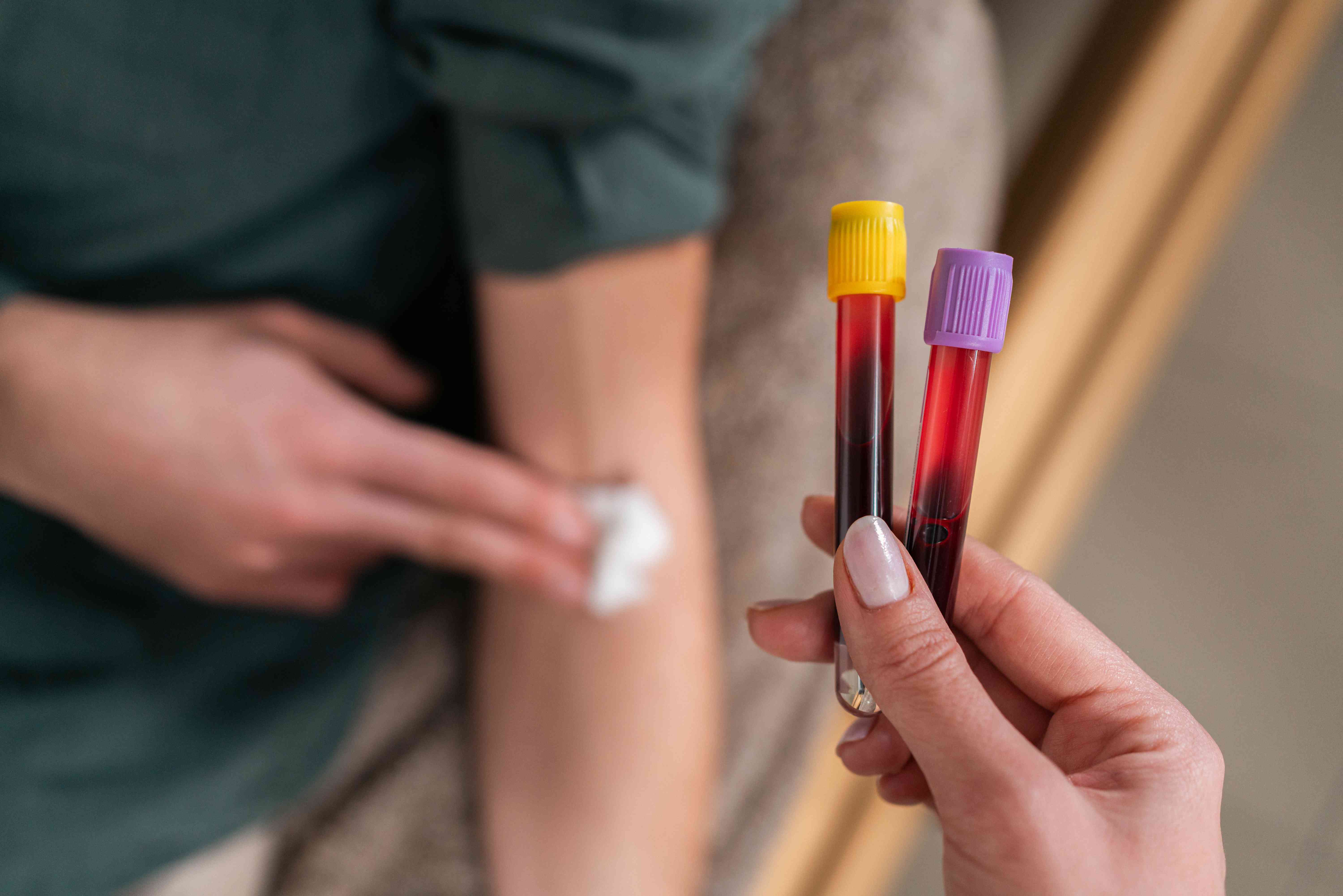 Looking for information on gloss of blood? Get the straightforward facts you need.