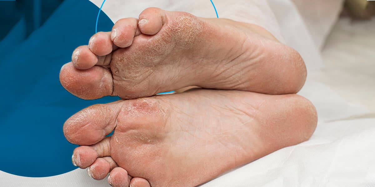 Why should I keep a foot record? (It helps you see changes in your feet early on!)