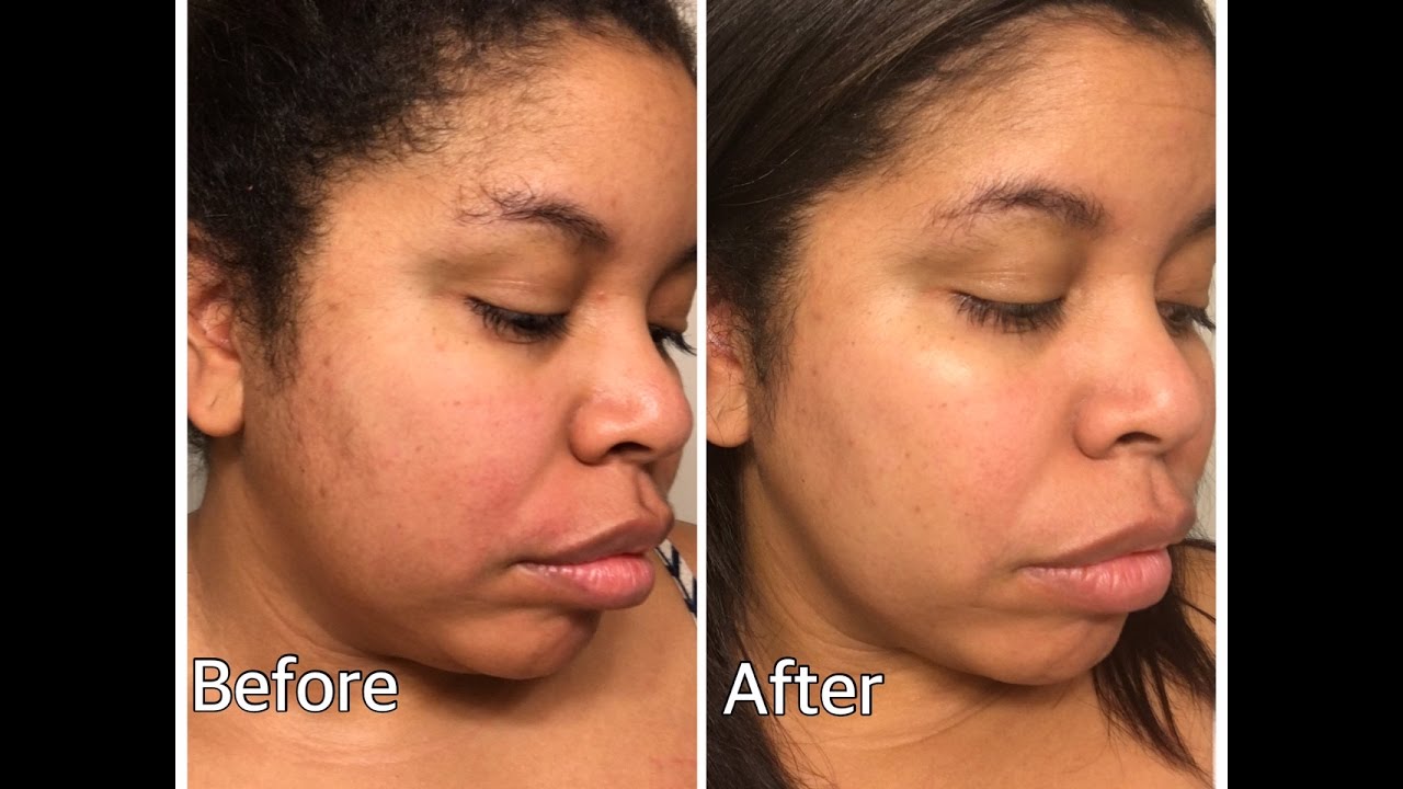 Philosophy Microdelivery Peel: How to Use It for Best Results?